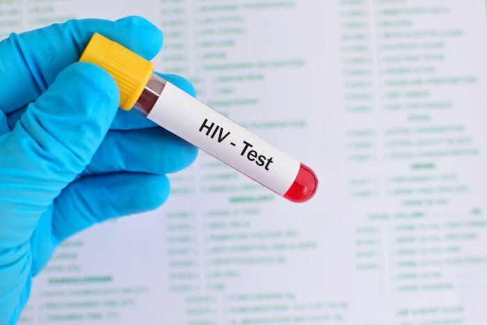 HIV test